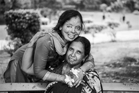 srk charity|Acid Attack Survivors in india.